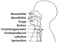 Schema des Sprechens mit Speisenröhrenstimme
